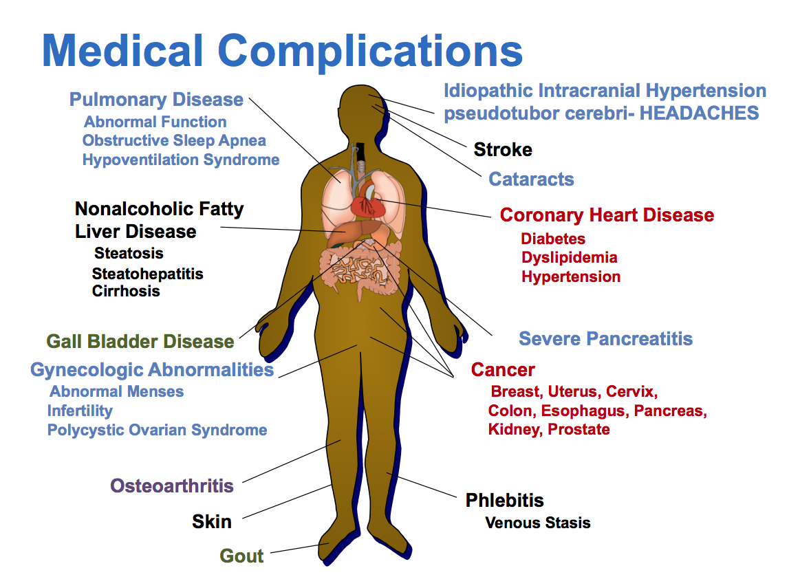 Medical Complication Related to Obesity